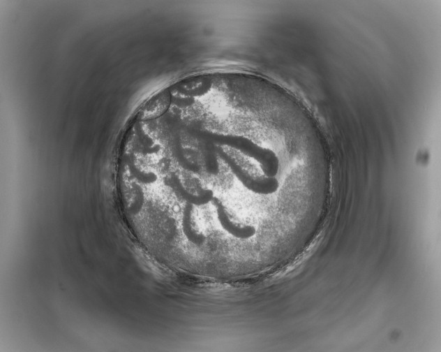 X0000099301405200805231332