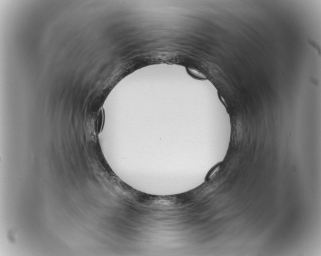 X0000099300236200805301140