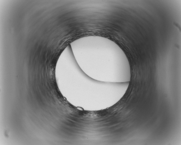 X0000099300276200805301139