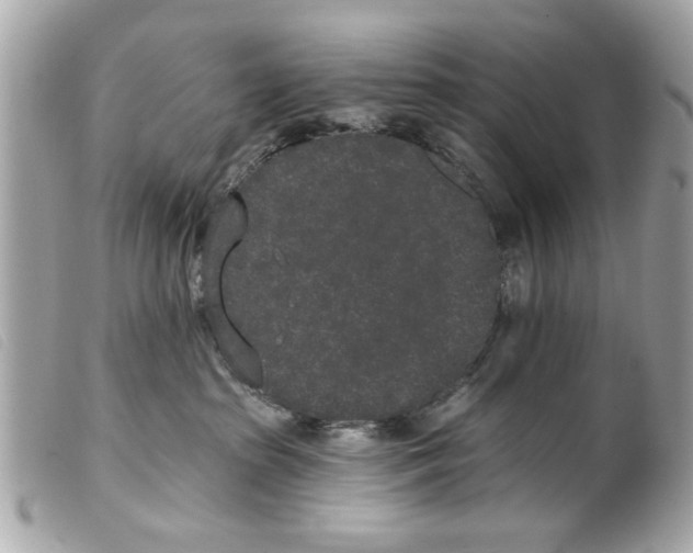 X0000099300285200805301139