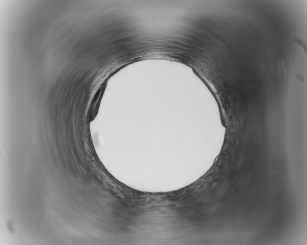 X0000099300289200805301139