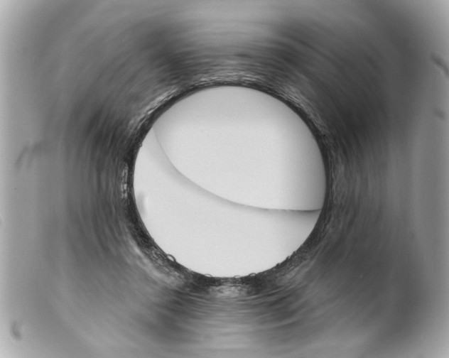 X0000099300356200805301138