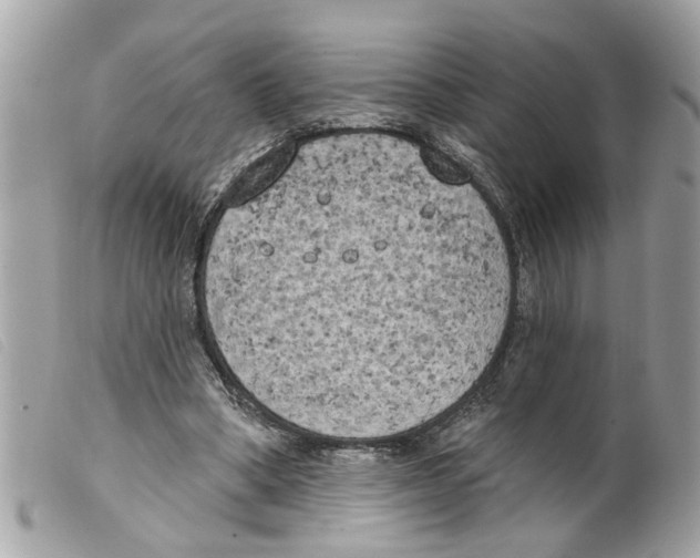 X0000099300394200805301137