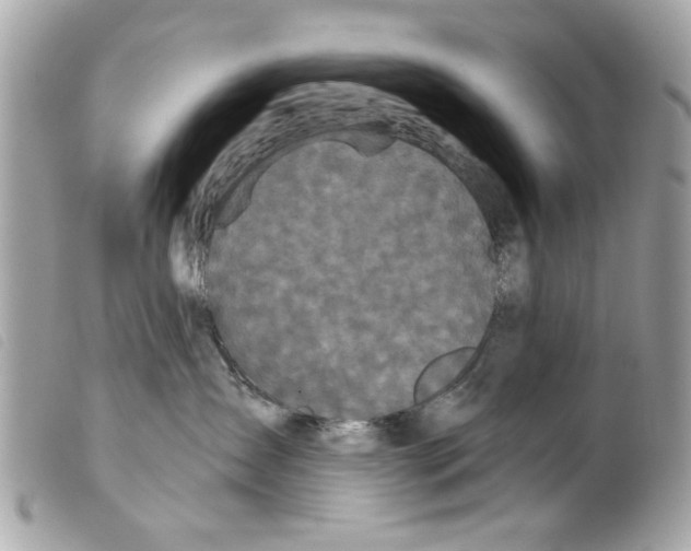 X0000099300431200805301137