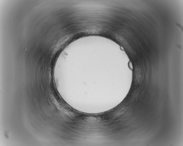 X0000099300494200805301136