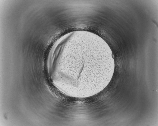 X0000099300496200805301136
