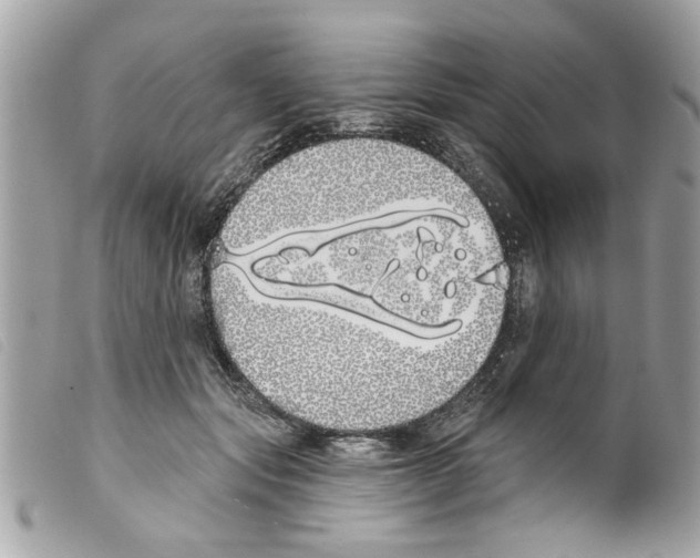 X0000099300557200805301135