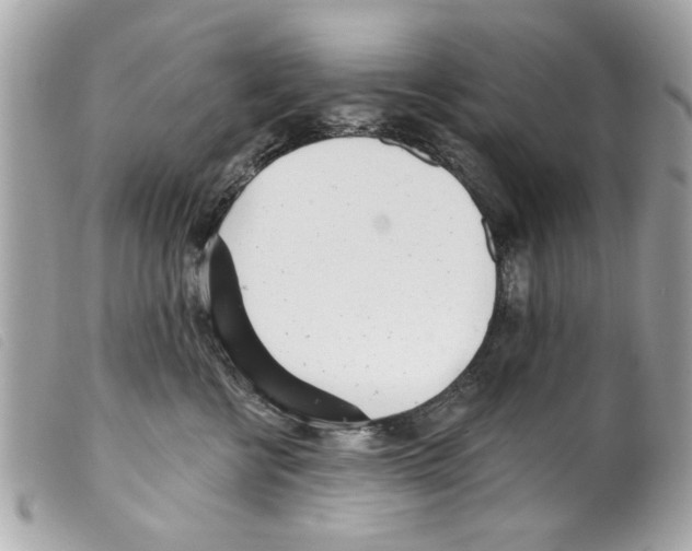 X0000099300570200805301135