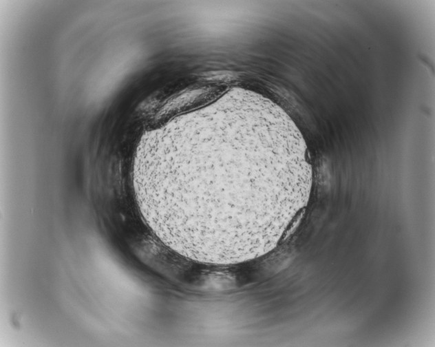 X0000099300572200805301136