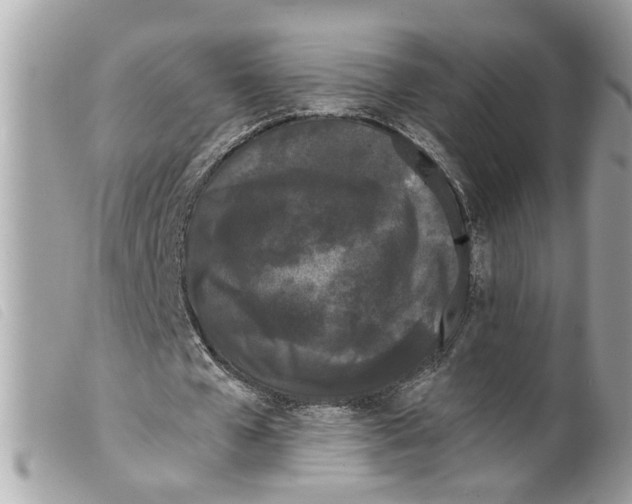 X0000099300577200805301135