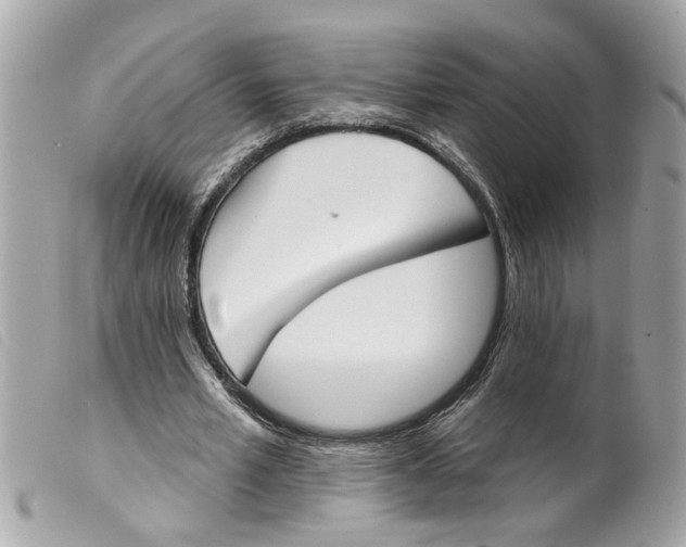 X0000099300581200805301135