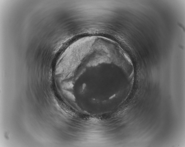 X0000099300592200805301135