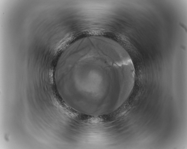 X0000099300696200805301133