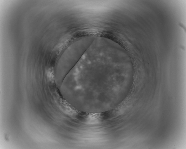 X0000099300720200805301133