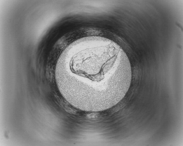X0000099300761200805301133