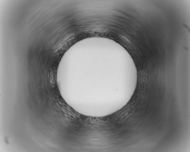 X0000099300774200805301133