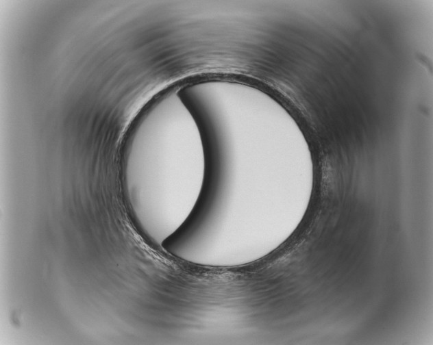 X0000099300926200805301130