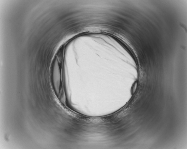 X0000099301045200805301129