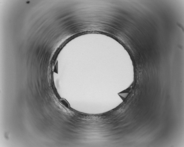 X0000099301076200805301128