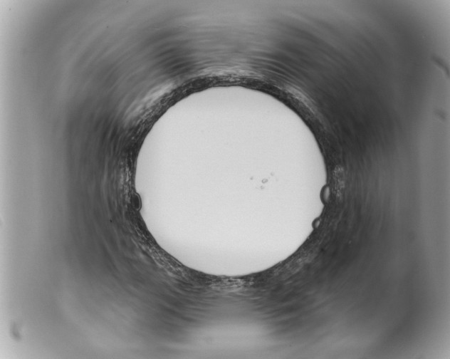 X0000099301111200805301127