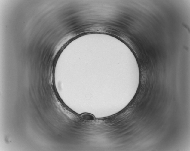 X0000099301131200805301127