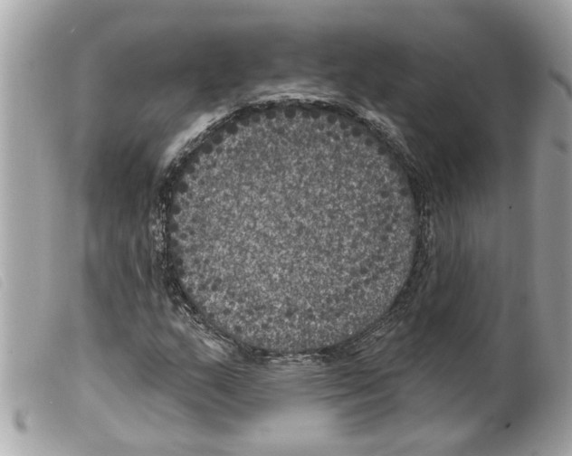 X0000099301159200805301127