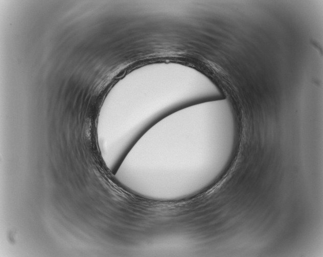 X0000099301161200805301127