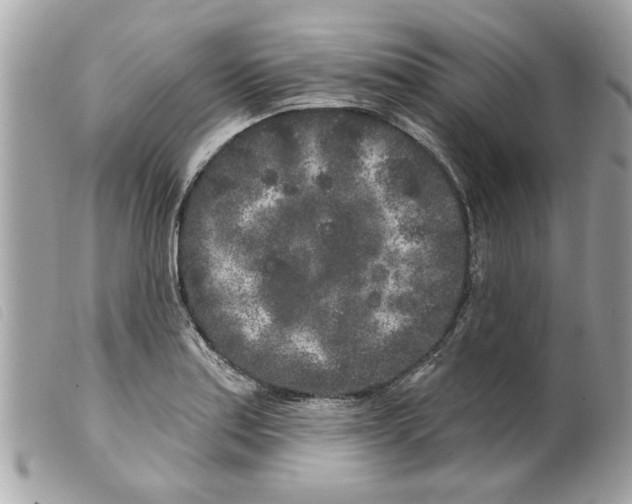 X0000099301179200805301127