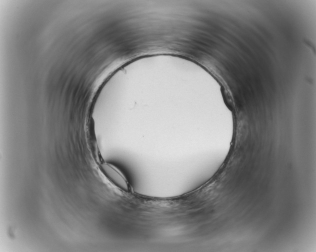 X0000099301197200805301127