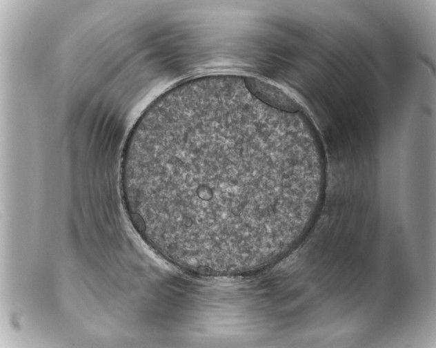 X0000099301333200805301125