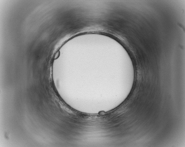 X0000099301366200805301124