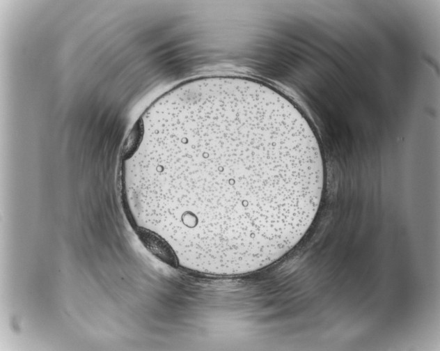 X0000099301387200805301124