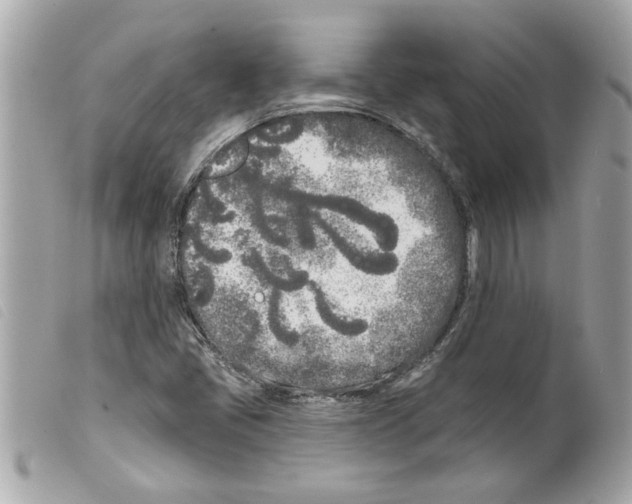 X0000099301405200805301123