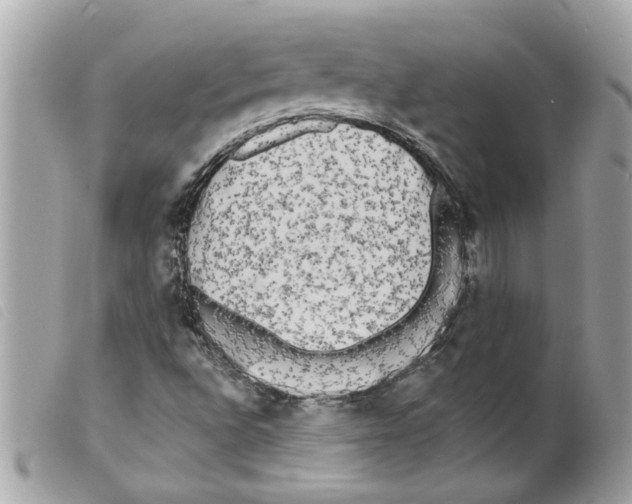 X0000099301496200805301122