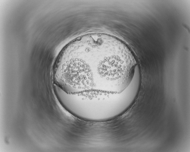 X0000099301519200805301122