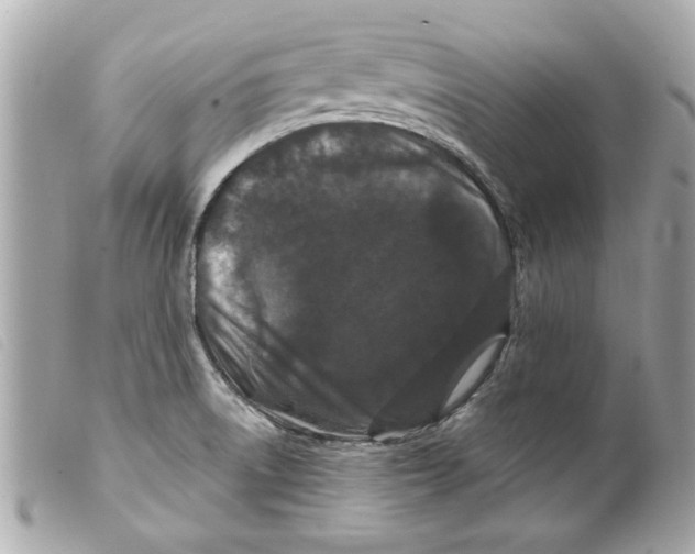 X0000099301522200805301122