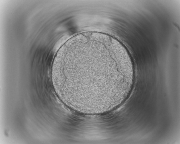 X0000099301529200805301122