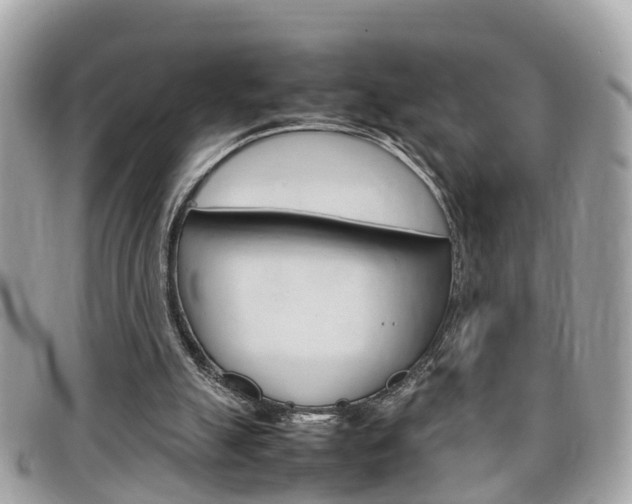 X0000099310055200805020740