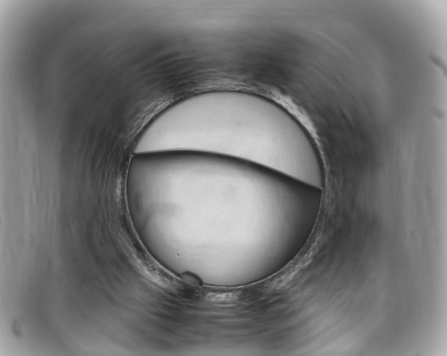 X0000099310057200805020740