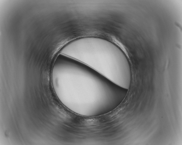 X0000099310059200805020740