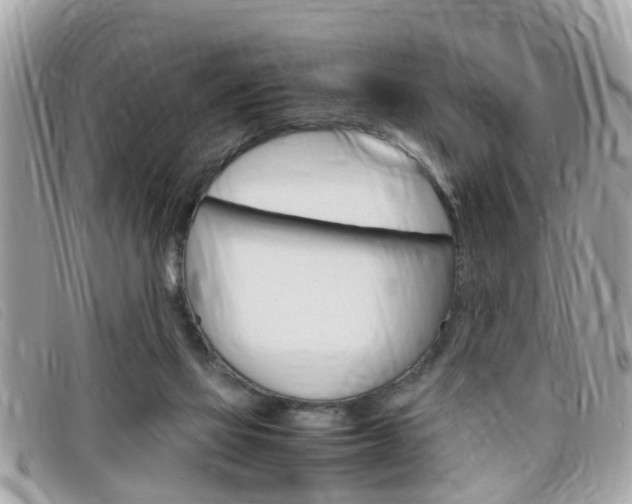 X0000099310069200805020741