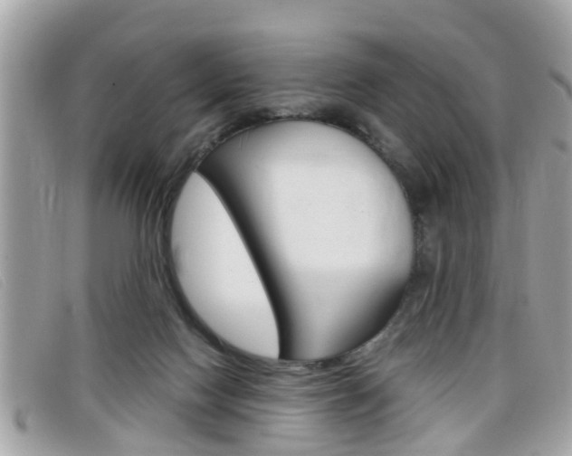 X0000099310074200805020741