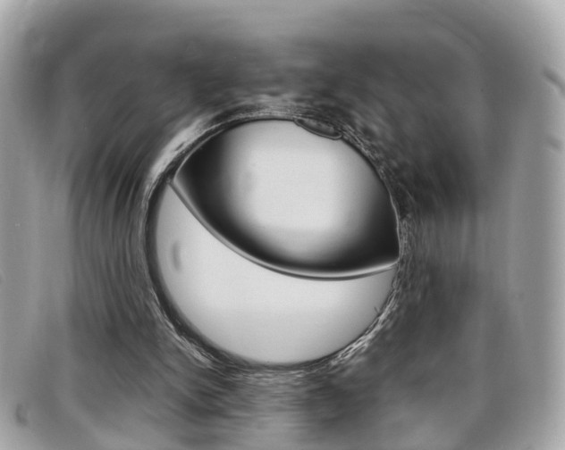X0000099310150200805020739