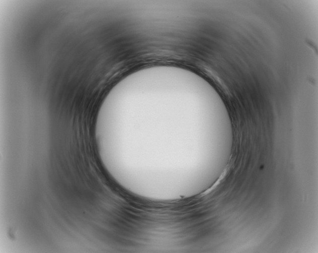 X0000099310170200805020739
