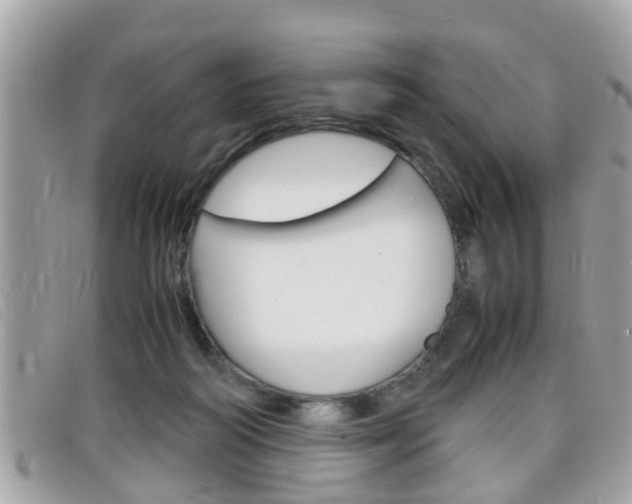 X0000099310218200805020739