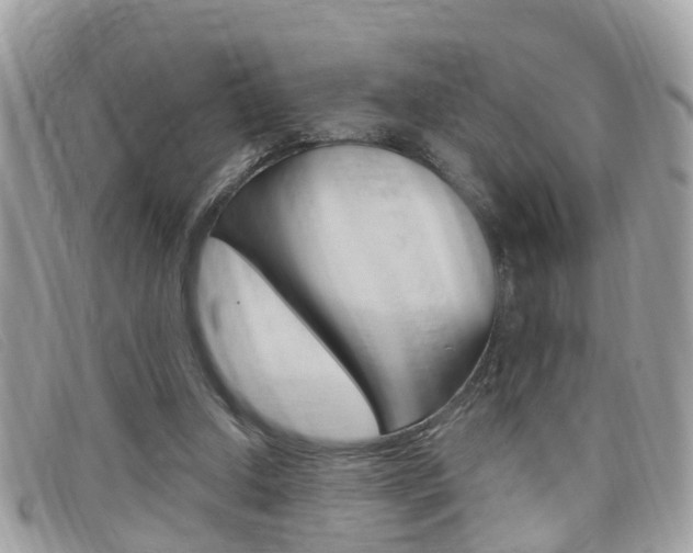 X0000099310250200805020738