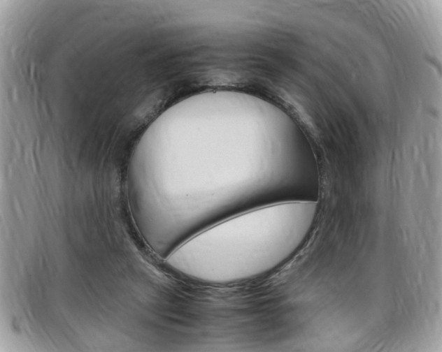 X0000099310257200805020738