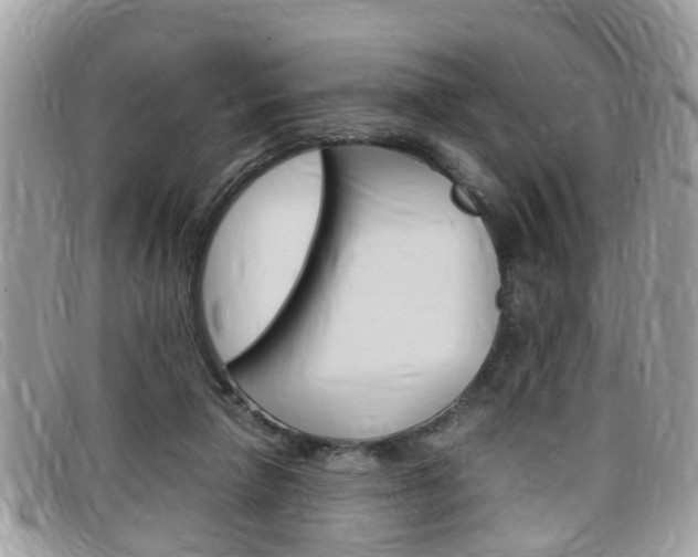 X0000099310258200805020738