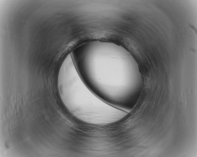 X0000099310260200805020738