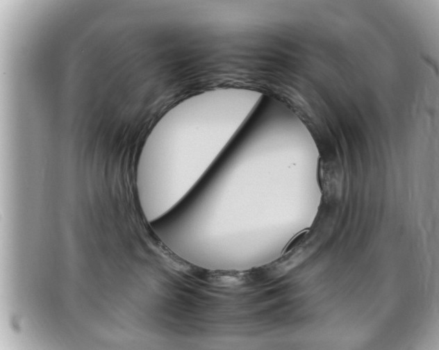 X0000099310285200805020738